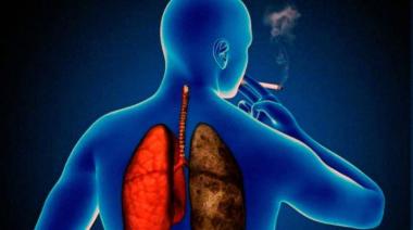 Realizan jornada de concientización por el Día Mundial de la EPOC